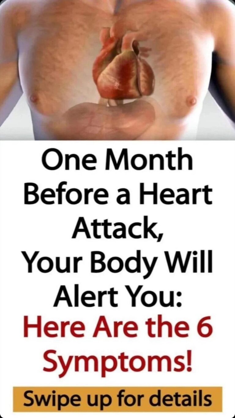 One Month Before a Heart Attack: 6 Symptoms to Look Out For