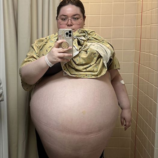 Her belly was getting bigger and bigger – doctors were shocked when they saw what came out