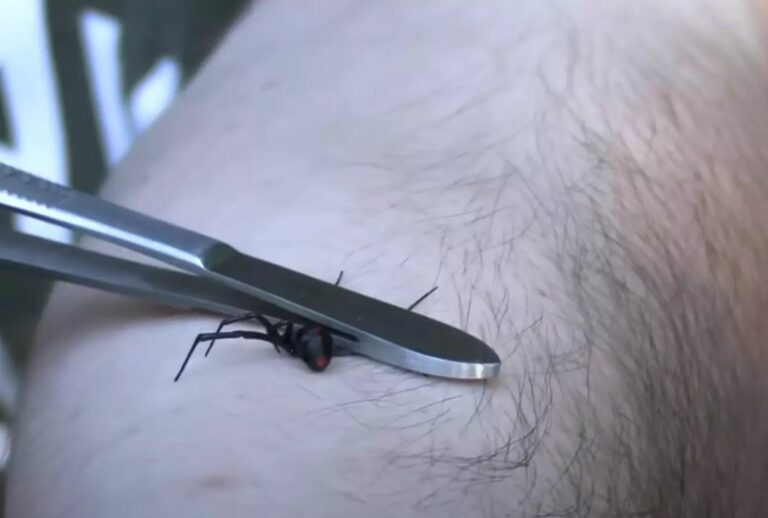 Wildlife Enthusiast Lets Black Widow Bite Him on Purpose to Debunk Myths Surrounding the Arachnid