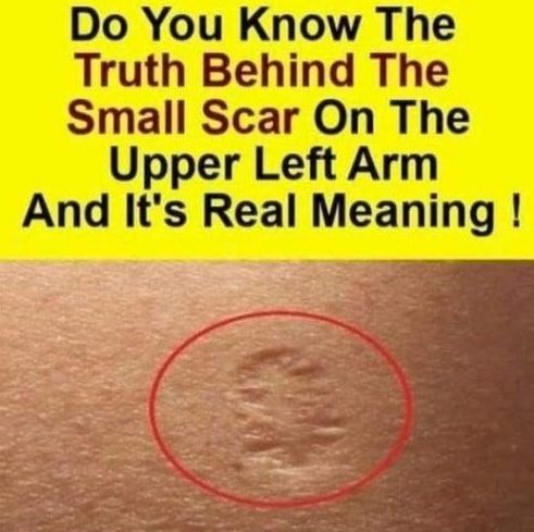 Do You Know The Real Significance Of The Small Scar