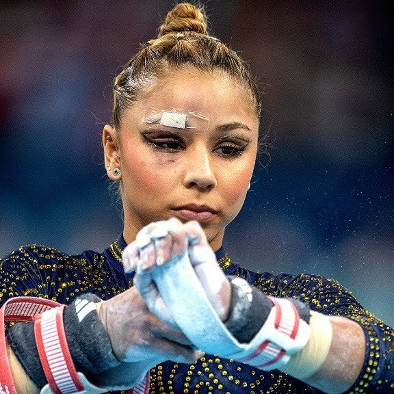 Why Did Flavia Saraiva Compete at the Olympics with a Bandaged Face – Top 3 Gymnast Injuries This Year