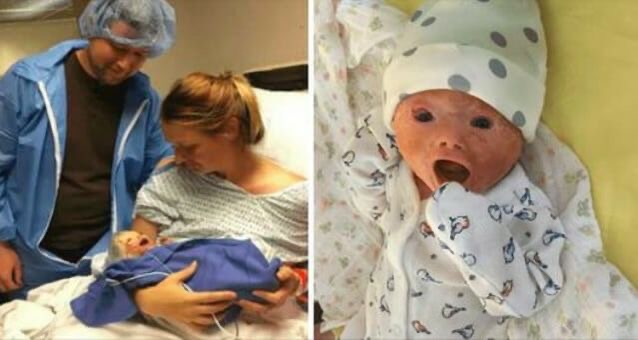 A baby with a rare skin disorder is born after an urgent C-section by medical professionals.