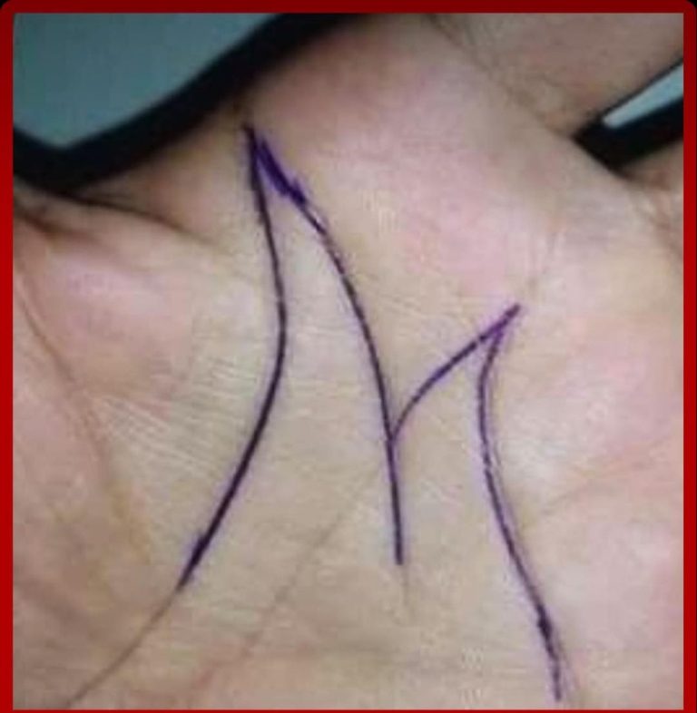 Why some people have an ‘M’ on their palm