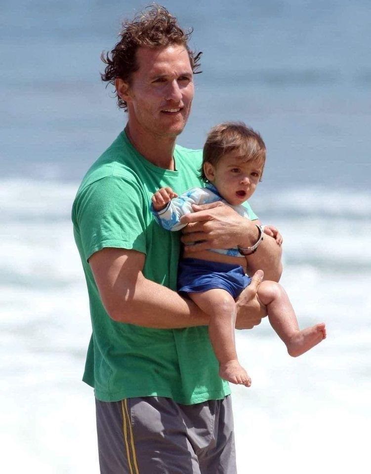 When displaying his son’s horrifying surf injuries, Matthew McConaughey refers to them as “souvenirs.”