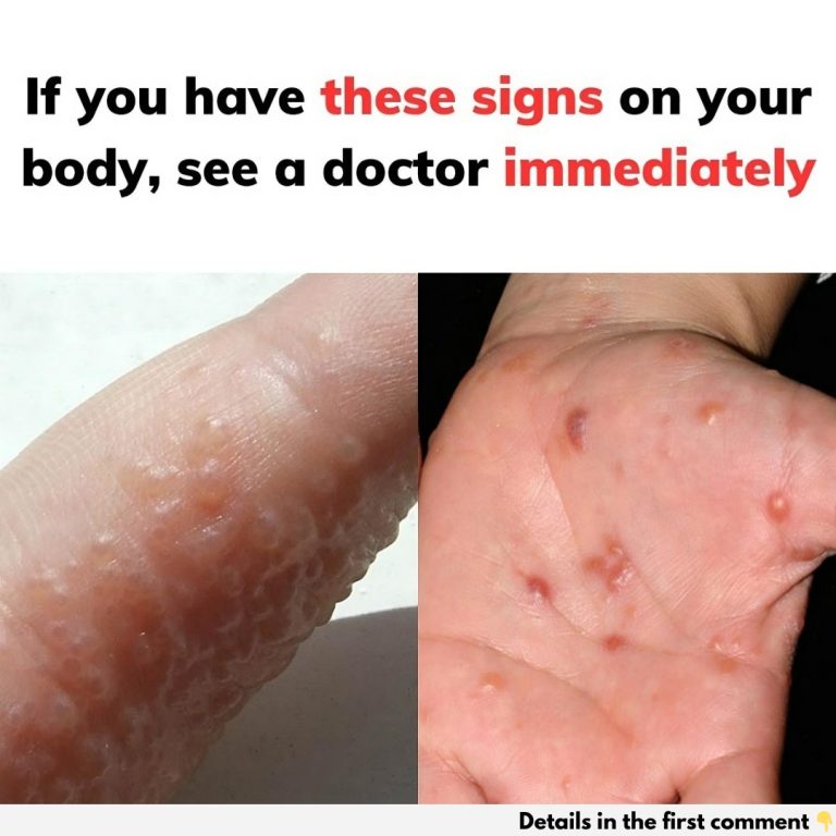 lf you have these sings on the body see a doctor immediaeIy