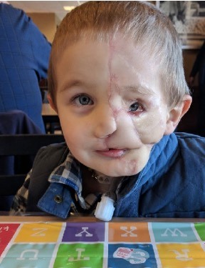 Boy, 5, survives savage attack by two ….