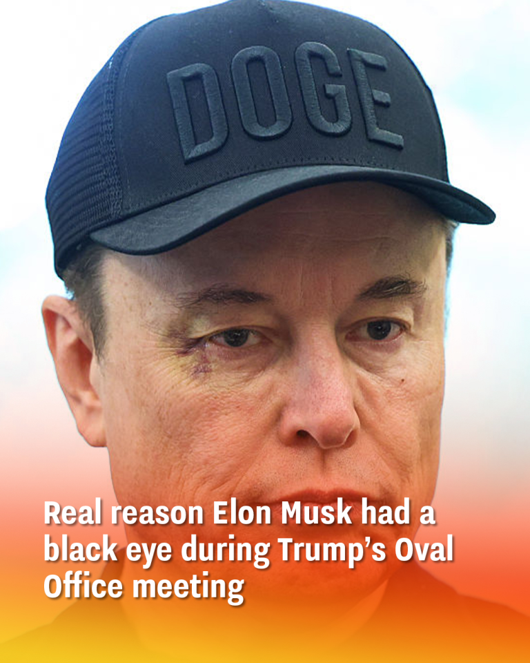 Real reason Elon Musk had a black eye during Trump’s Oval Office meeting