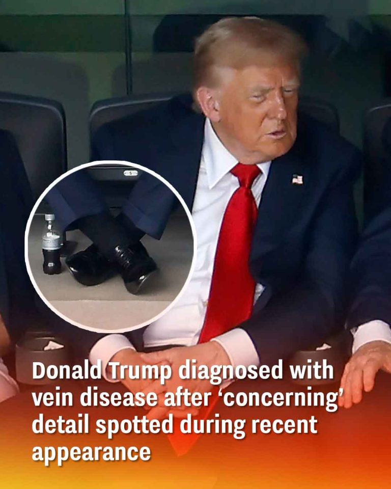 Donald Trump diagnosed with vein disease after ‘concerning’ detail spotted during recent appearance