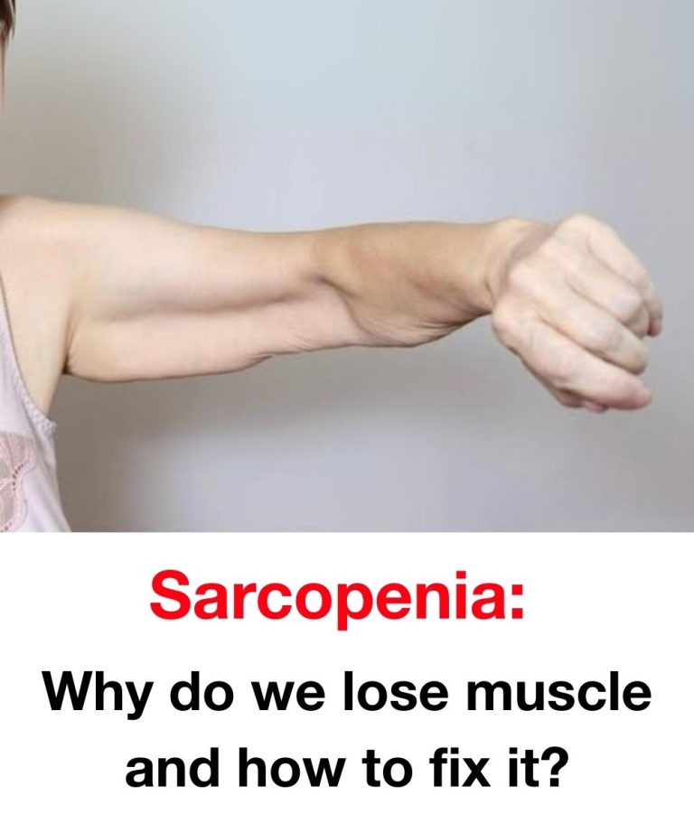 Understanding Sarcopenia: Muscle Loss Causes and Remedies