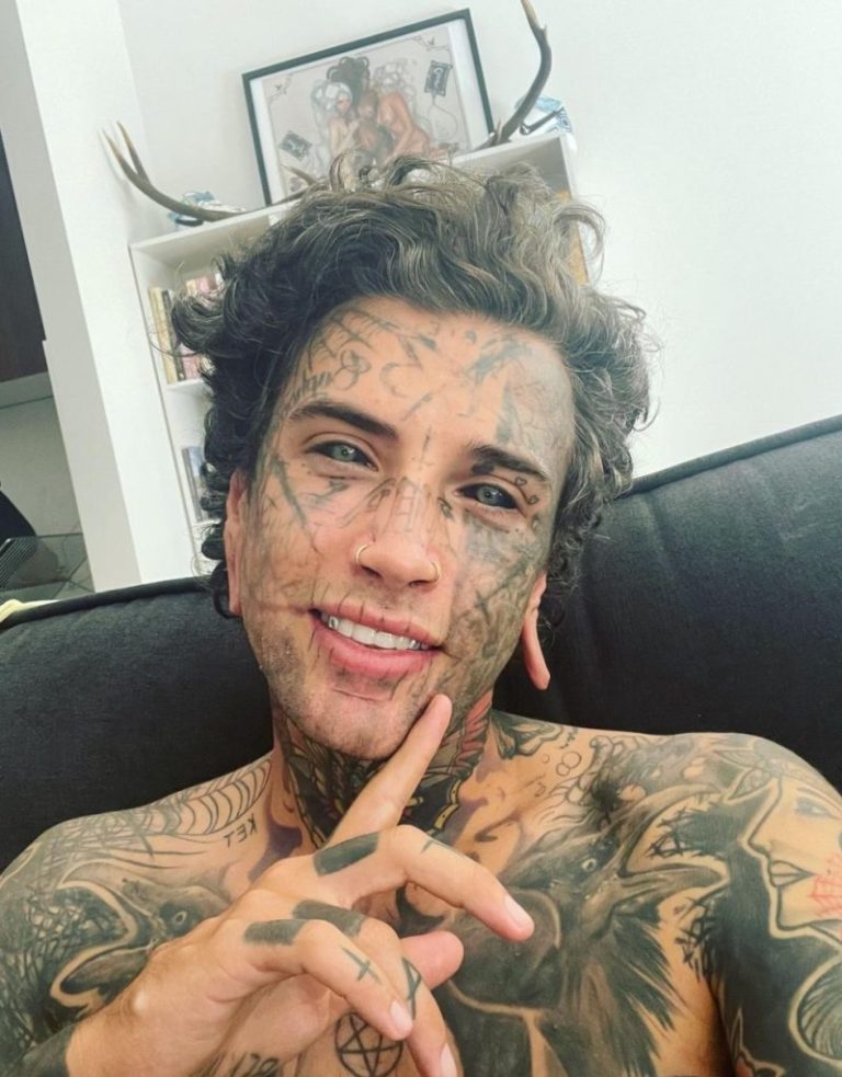 Tattooed Dad Begins Painful Journey to Erase His Past — Here’s Why