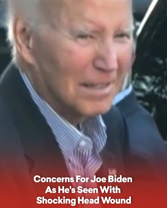 Concerns For Joe Biden As He’s Seen With Shocking Head Wound