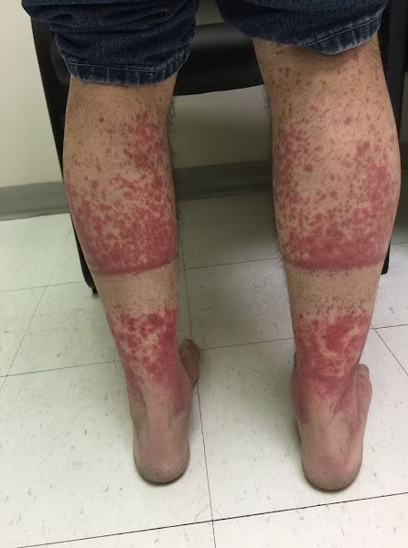 These are the consequences of sleeping with the…