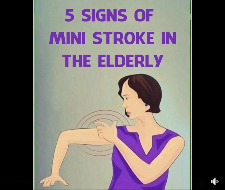 When Changes in Aging May Signal a Mini-S