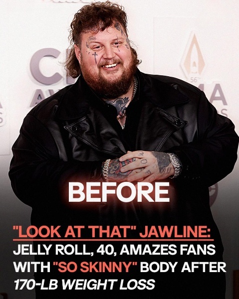 At 40, Jelly Roll Wows Fans With ‘So Skinny’ Transformation Following Massive Weight Loss