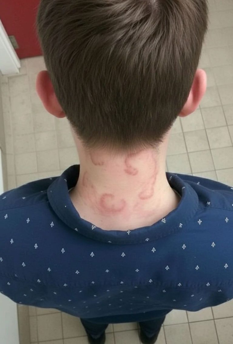 My 8 year old son been having this